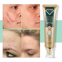 acne scar cream old new scars eliminating gel deep repair damaged skin remove stretch marks whitening moisturizing body care 30g