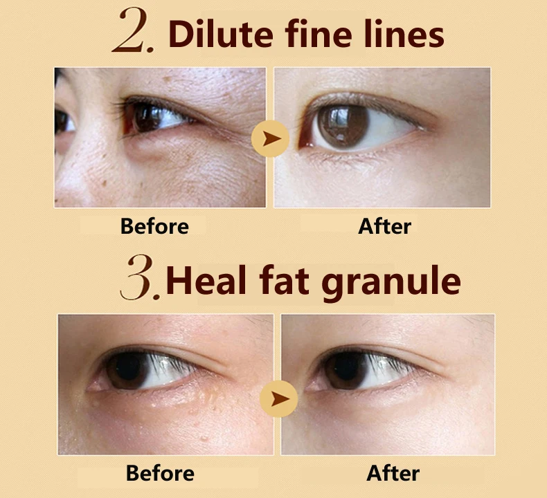 10 шт./партия Уход за глазами и маска золотая с кристаллами коллагена уход кожей