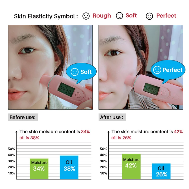 Увлажняющее масло для ухода за кожей эфирное Удаления растяжек после