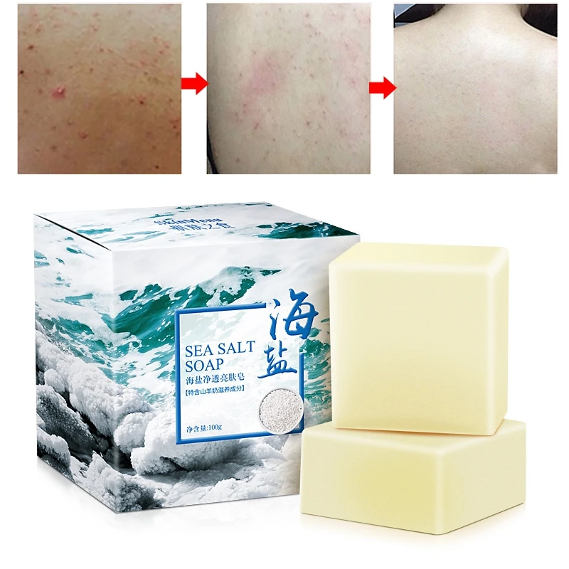 

Hot 100g Sea Soap With Salt Cleaner To Remove Pimple Pores Acne Goat Treatment Moisturizing Milk Facial Wash Basis Soap Savon