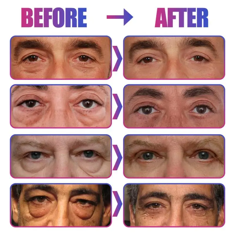 

30ml Eye Cream Day And Night Dark Dark Circles Remover Eyes Of Tight Anti Aging Cream Men Skin Care TSLM2