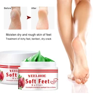 anti dry skin cream hand and foot crack cream heel chapped peeling foot cracking repair vitamin e moisturizing moisturizer tslm1