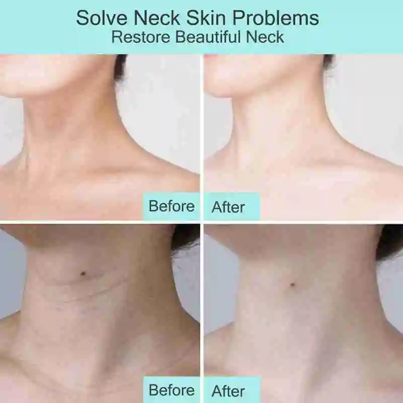 

Anti-aging Wrinkle-removing Whitening Firming Moisturizing Collagen Cream Neck L7W2
