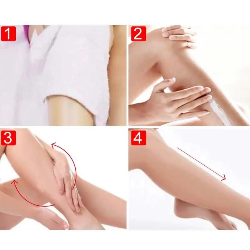 

Varicose Veins Treatment Cream Ointment Vasculitis Remedy Varicosity Cream Phlebitis Pain Spider Veins Q Angiitis Removal H Y9R3