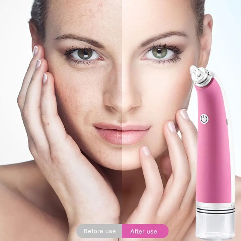 

Electric Bubble Blackhead Remover Nose Cleaner Vacuum Loop Suction Deep Clean Pore Remove Acne Cleaning Skin Care Tool