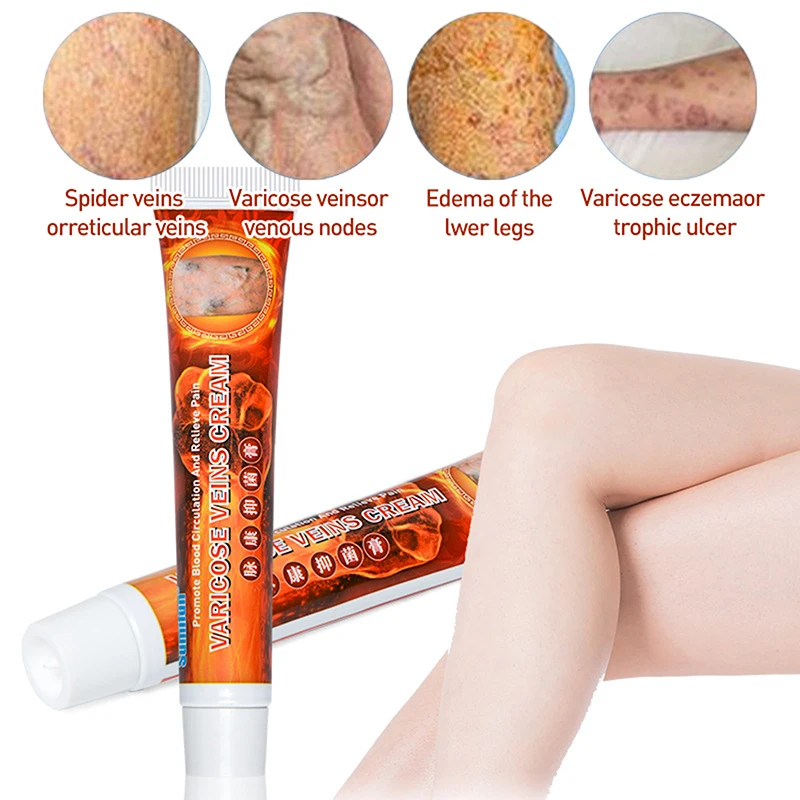 

1 шт., гигиенический крем от варикозного расширения вен
