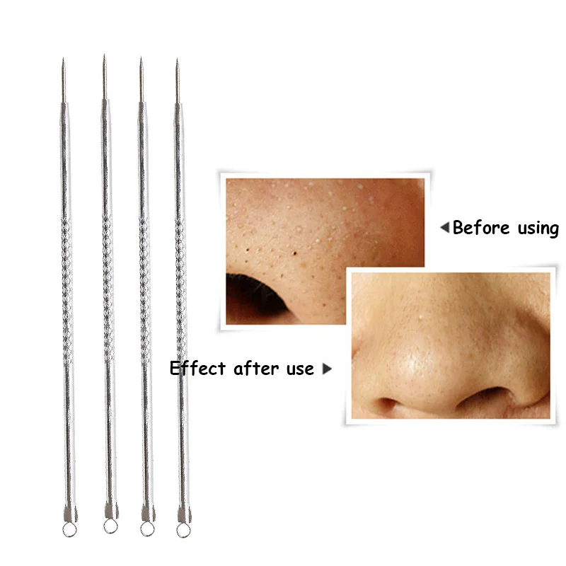 Инструмент для удаления чёрных точек на лице и прыщей| |