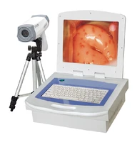 free shipping hd full digital video electronic colposcope work station