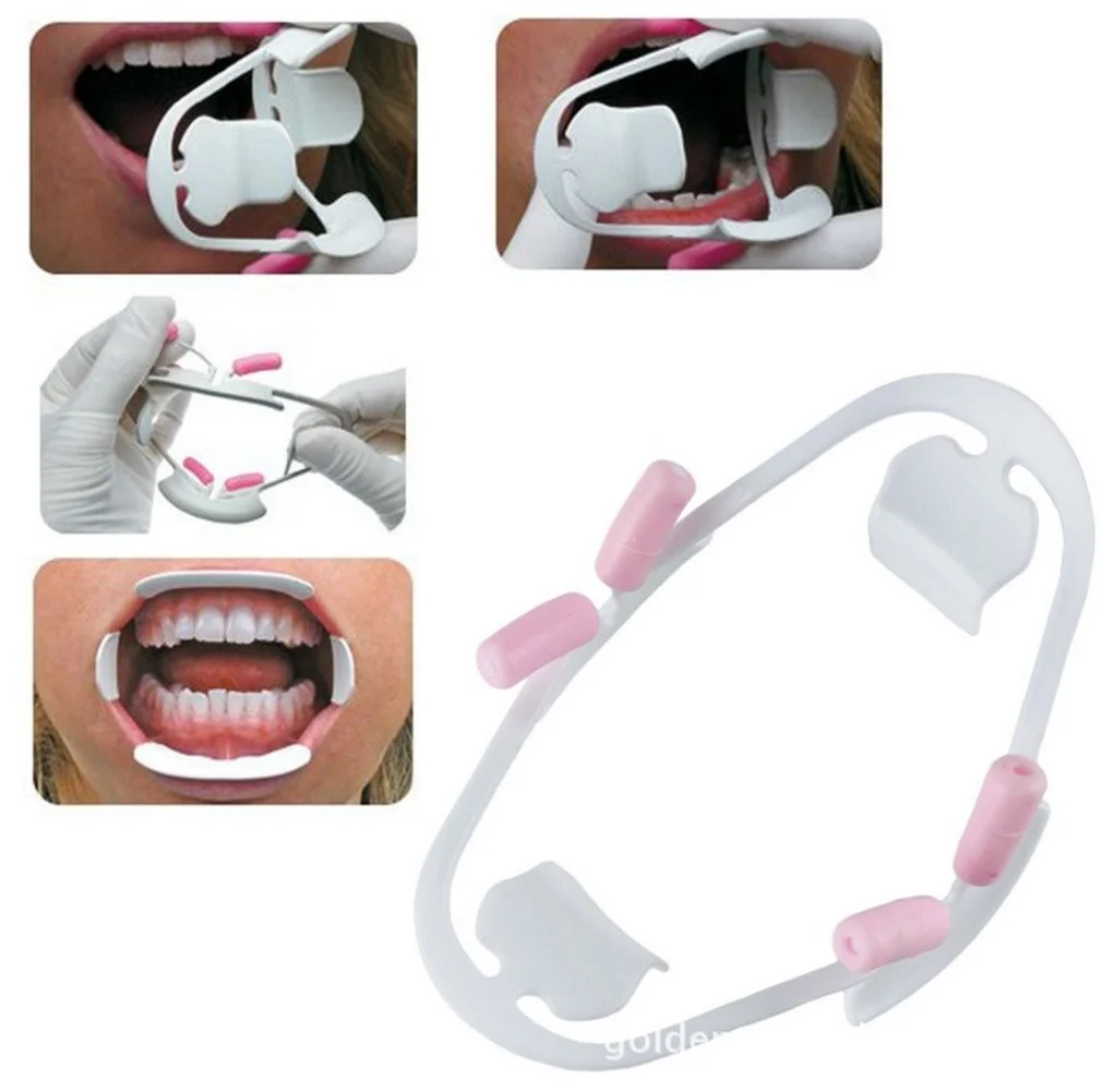 

3D Oral Dental Mouth Opener Dental Instrument Lip Cheek Retractor Orthodontic Professional Dentist Tools Dentistry Materials