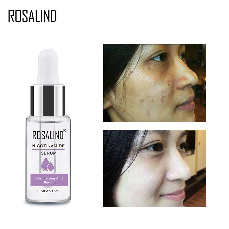 ROSALIND Niacinamide Сыворотка для лица от морщин отбеливающий увлажняющий Крем