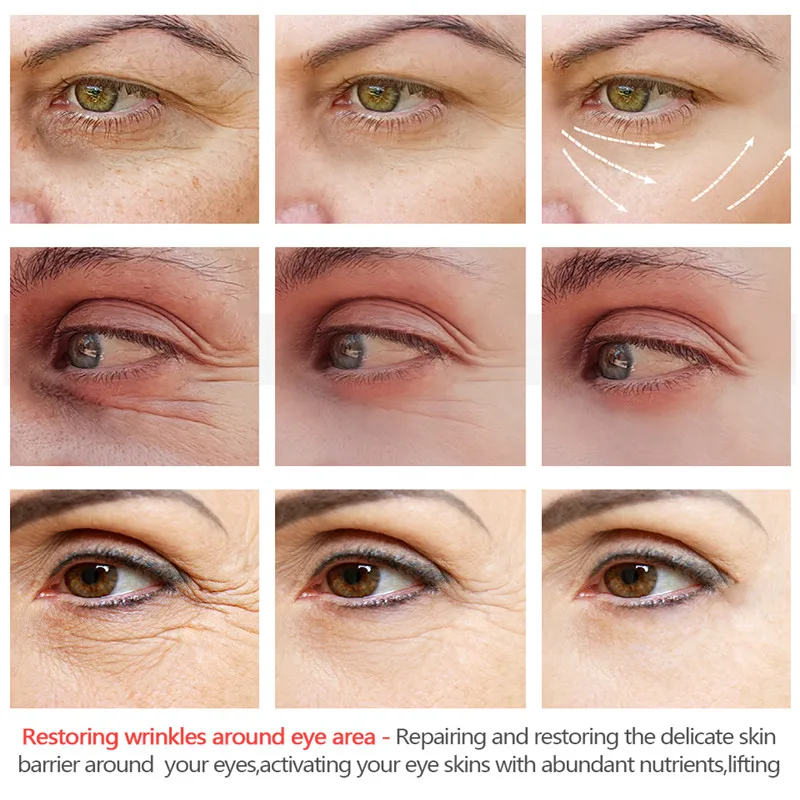 Minch Carrot Eye Cream Remove Bags Blemish Anti Puffiness Dark Circles Delays Anti-wrinkles Firming Brighten Skin Unisex | Красота и