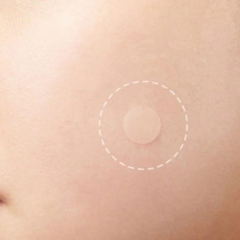 

K-STAR 36Pcs Hydrocolloid Acne Facial Care Tool Blackhead Removers Invisible Pimple Master Blemish