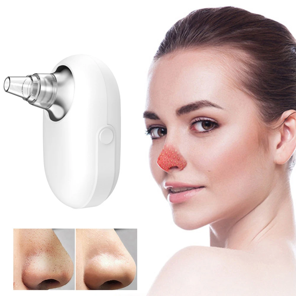 

Blackhead Remover Vacuum Pore Cleaner Suction Face Acne Black Spot Extractor Rechargeable Five Changeable Beauty Heads