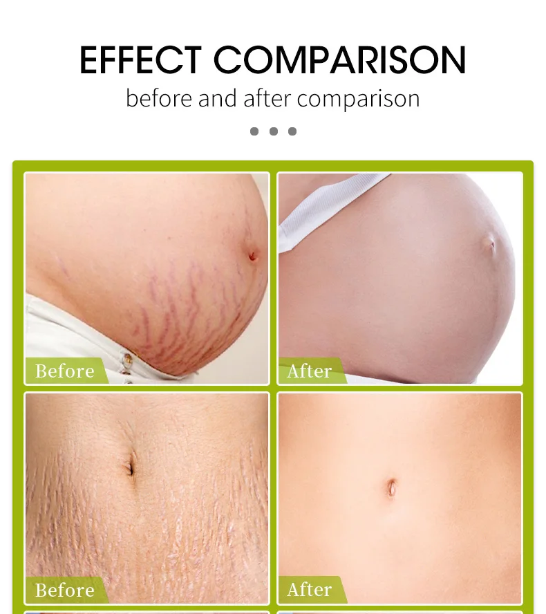 Dimollaure 50 г-500 г органическое масло ши восстанавливает растяжки для беременных уход