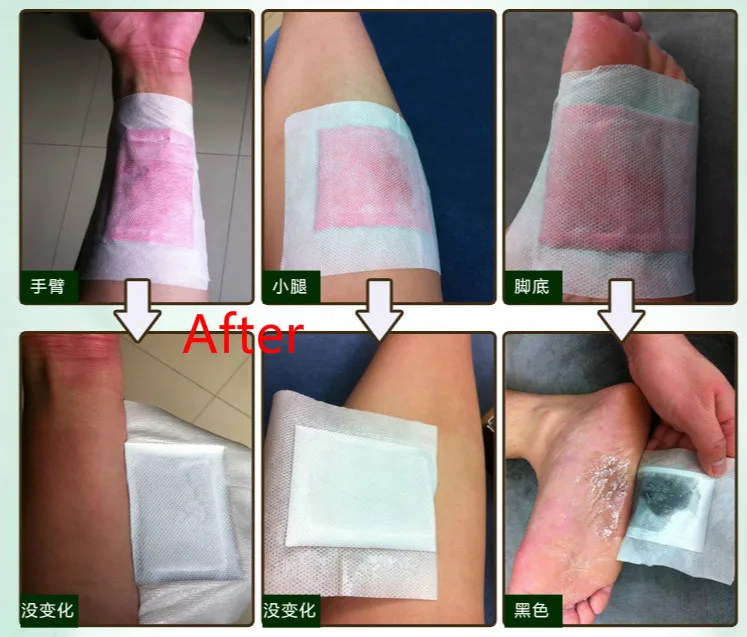 10 шт. травяные Детокс Патчи для ног колодки тела токсинов похудения очищающий