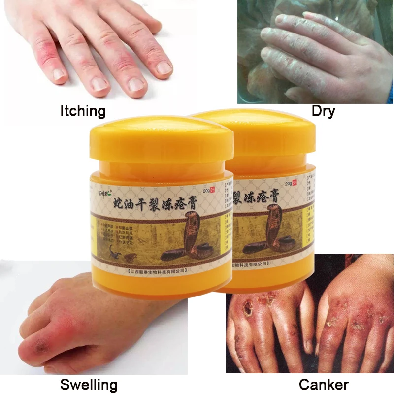20G Winter Essential Snake Oil Anti-Chapping Dry Crack Treat Frostbite Hand Itching Redness Moisturizer Repair Skin Ointment | Красота и