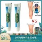 Мазь для варикозных вен, васкулит, тонус, венозная мазь, тонус, варикозное расширение вен, массажный крем, 1 шт.