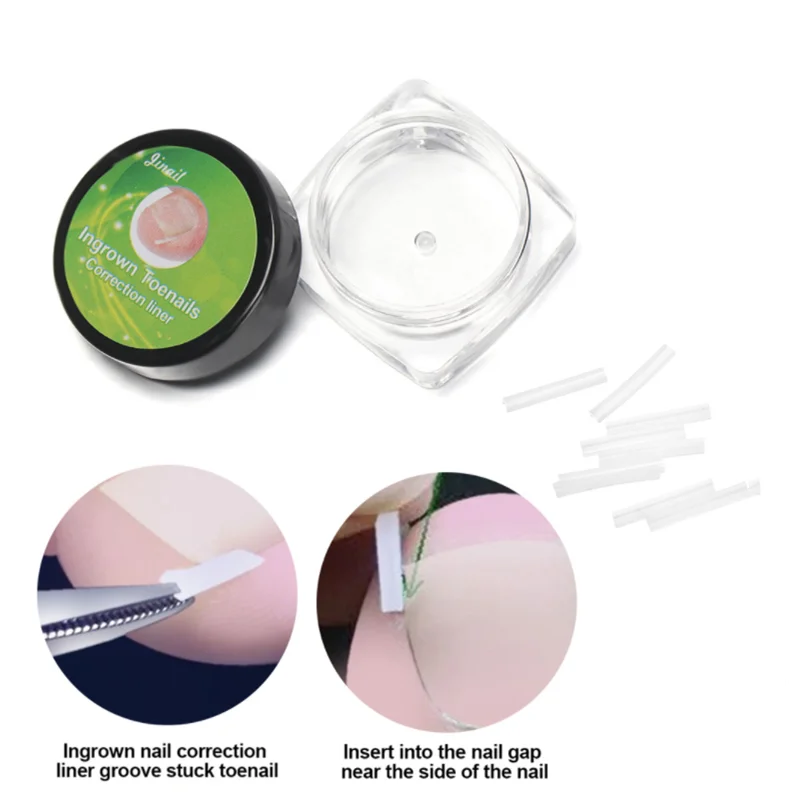 10 шт./компл. Подушечка Для вросших ногтей Орто Наполнения Корректор для