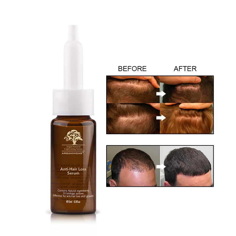 15ml Anti-hair Loss Ginger Oil Hair Growth Product Natural extraction material For Man and Woman Free Shipping | Красота и здоровье