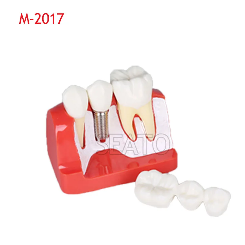 Модель для обучения стоматологическим зубам стандартная модель