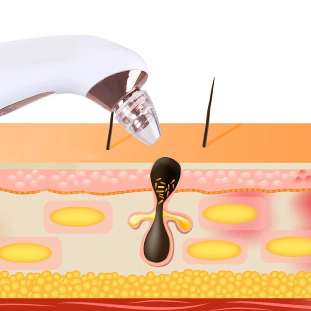 Вакуумный прибор для удаления черных точек ПОР акне прыщей USB Устройство ухода