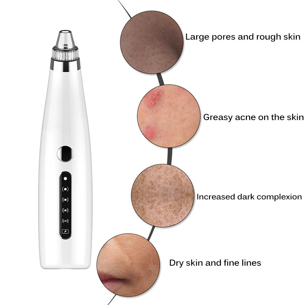 Аппарат для удаления черных точек вакуумный аппарат очистки пор глубокое