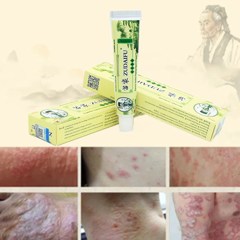 

Zudaifu Dermatitis Treatment Eczematoid Eczema Ointment Treatment Psoriasis Cream Body Antipruritic Antibacterial Skin Care