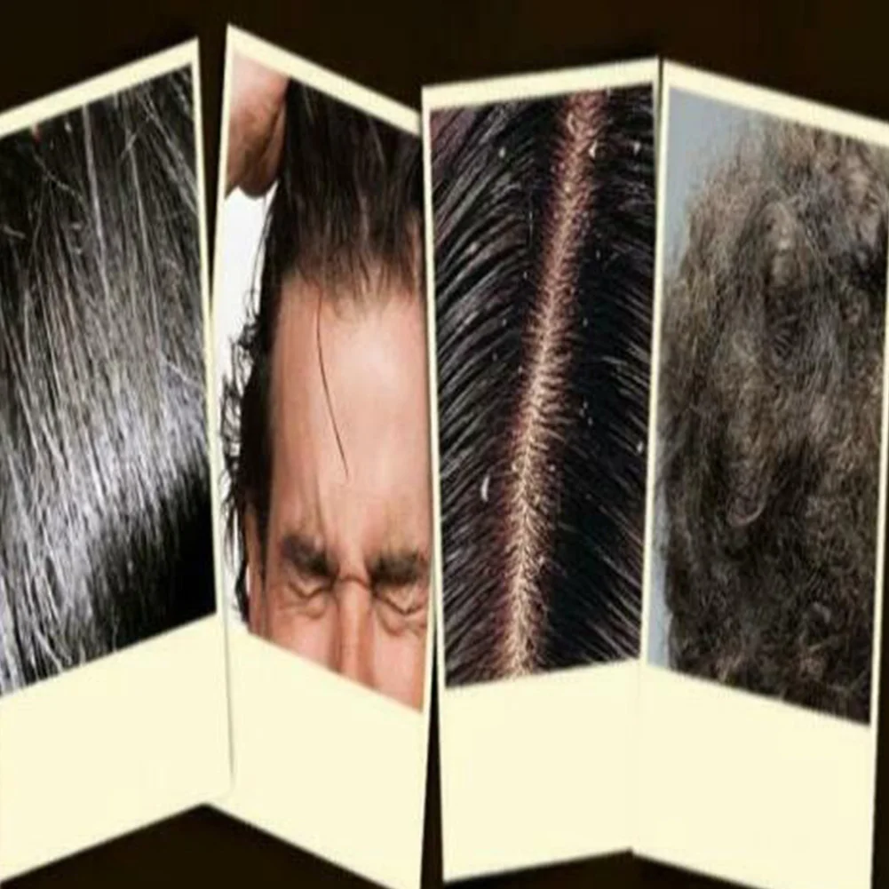 

Black Hair Shampoo for Grey Hair Reverse Women Men Solid Hair Anti-Dandruff moisturizing and repairing natural gentle formula