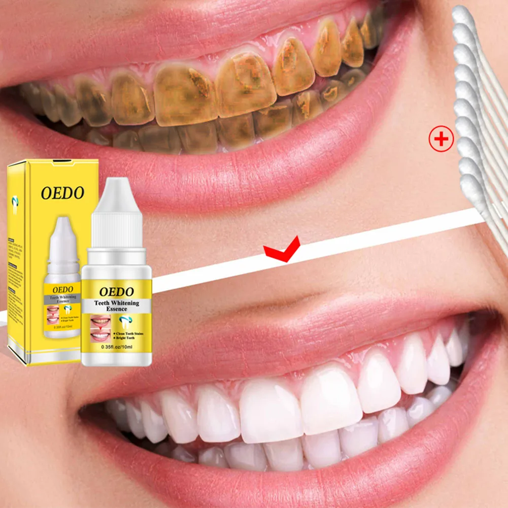 10 мл эссенция жидкость для отбеливания зубов удаление зубного налета сыворотка