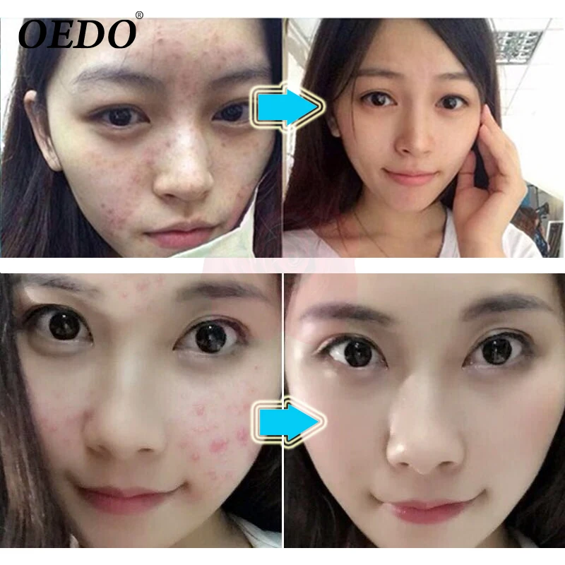 Завод добычи ремонт парк Спрингс аккор женьшень шлемника экстракт Уход за лицом