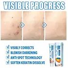 24g бородавки крем для кожи для удаления этикеток Антибактериальный крем бородавки, антибактериальная мазь от тела экстракт уход за кожей лица травяные мазь микро уход моль L5A0