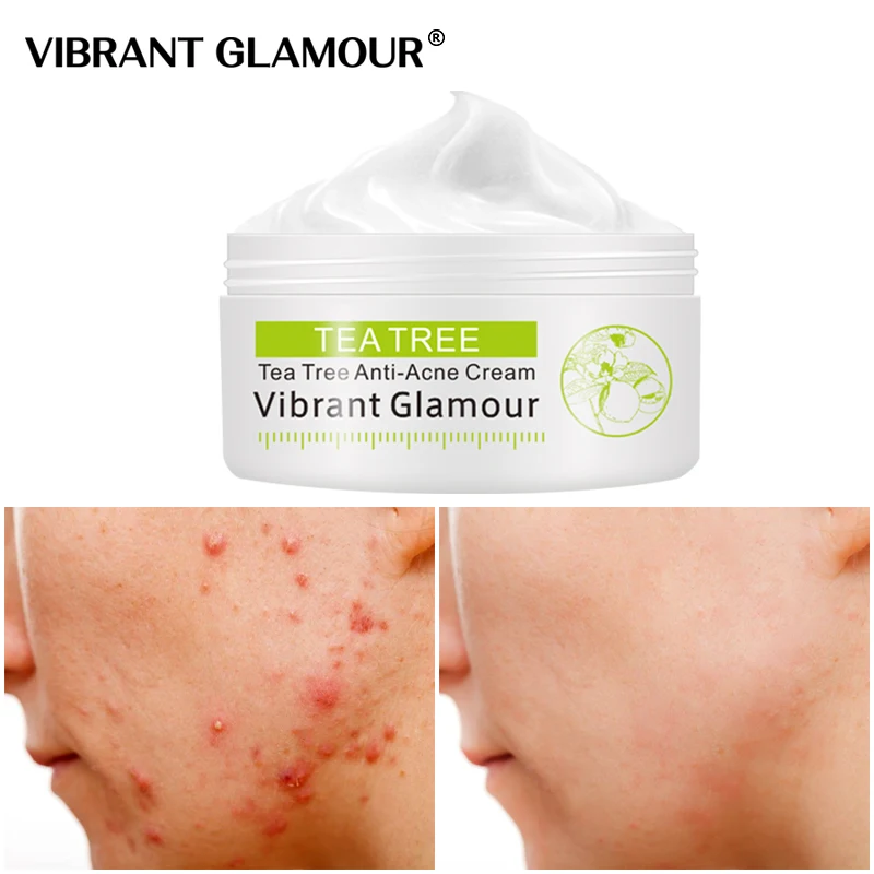 Чайное дерево крем для лица анти-масло от акне контроль Усадочные поры уход за