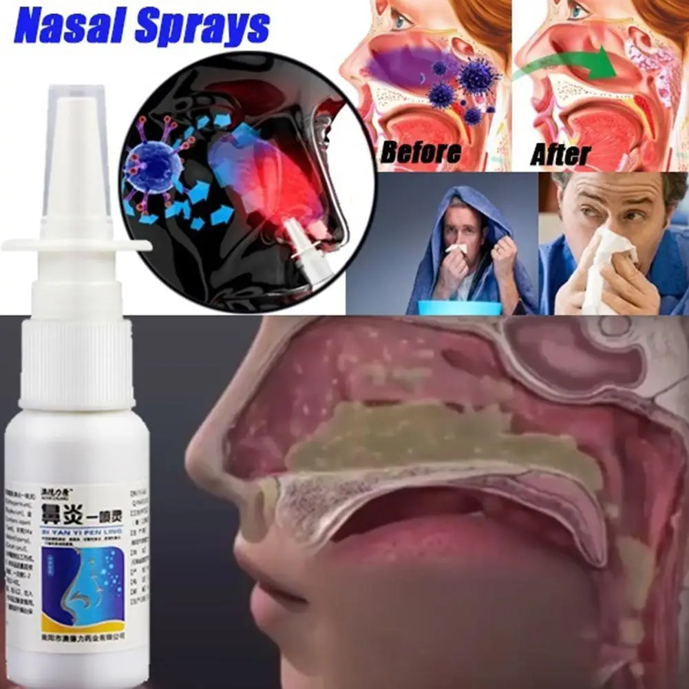 

Rhinitis Sprays Chronic Sinusitis Chinese Medicinal Products Treatment Care Nose Nasal Health Spray Herb T4J1