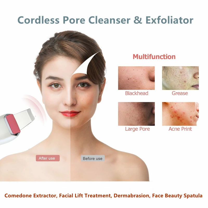 KSBELLE Высококачественная ультразвуковая машина для очистки ионов и угрей