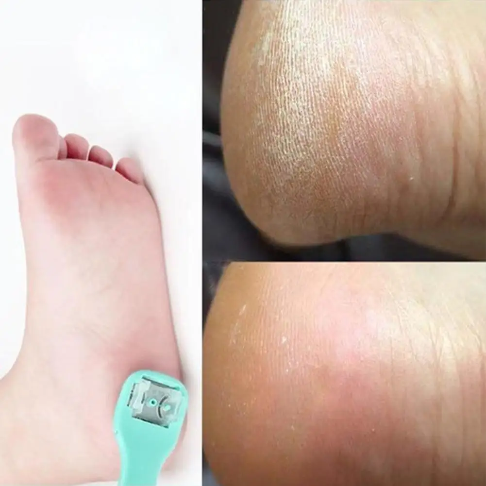 

Professional Pedicure Foot Care Tool Dead Hard Skin Callus Tools Pedicure Feet Tool Care Scraper Remover Rasp Z6N3