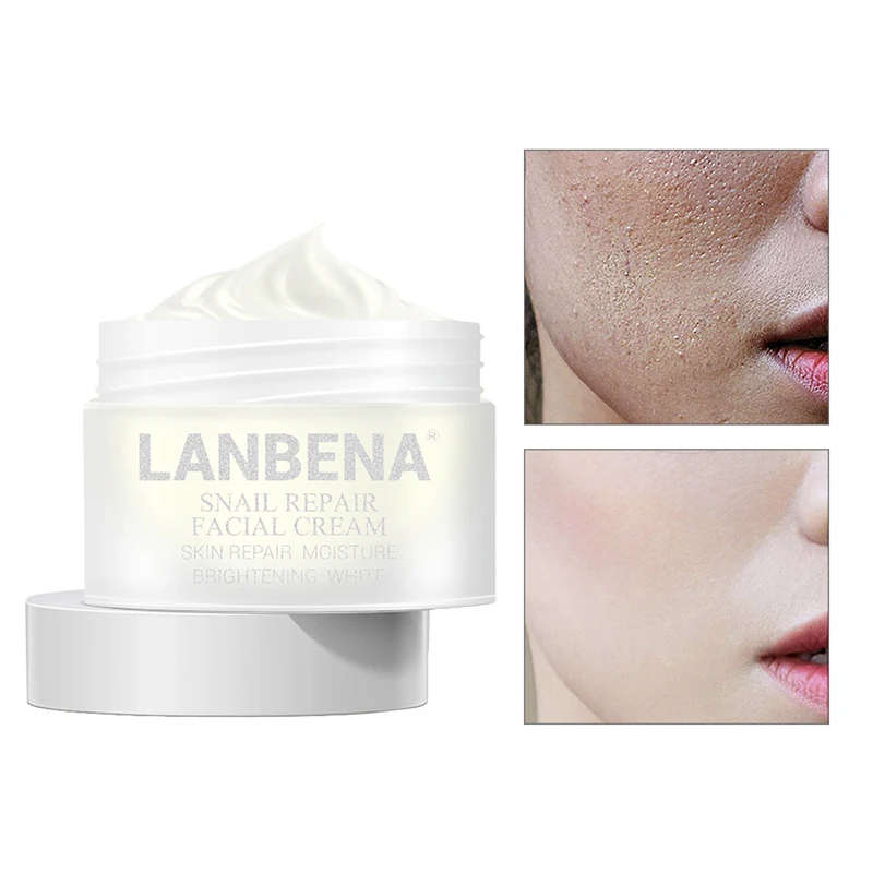LANBENA 30 г Улитка восстановление и отбеливание крем для лица дневной против морщин