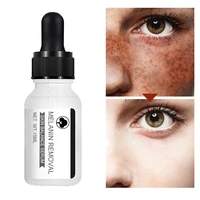effective whitening freckle serum remove dark spots anti acne fade pigmentation essence anti melasma brighten moisturizing care