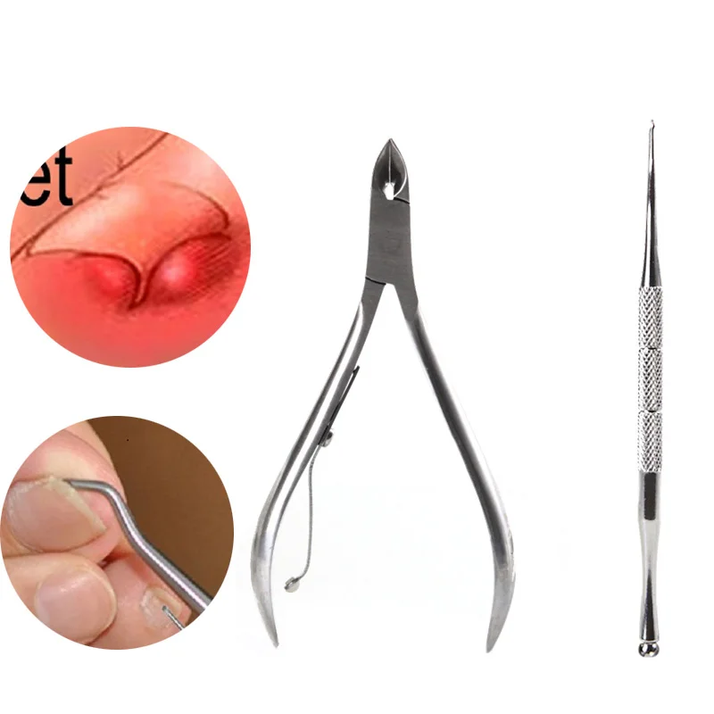 2PCS/Set Ingrown Foot Care Tool Toe Nail Correction Nippers Clipper Cutters Dead Skin Dirt Remover Paronychia Podiatry Pedicure | Красота и