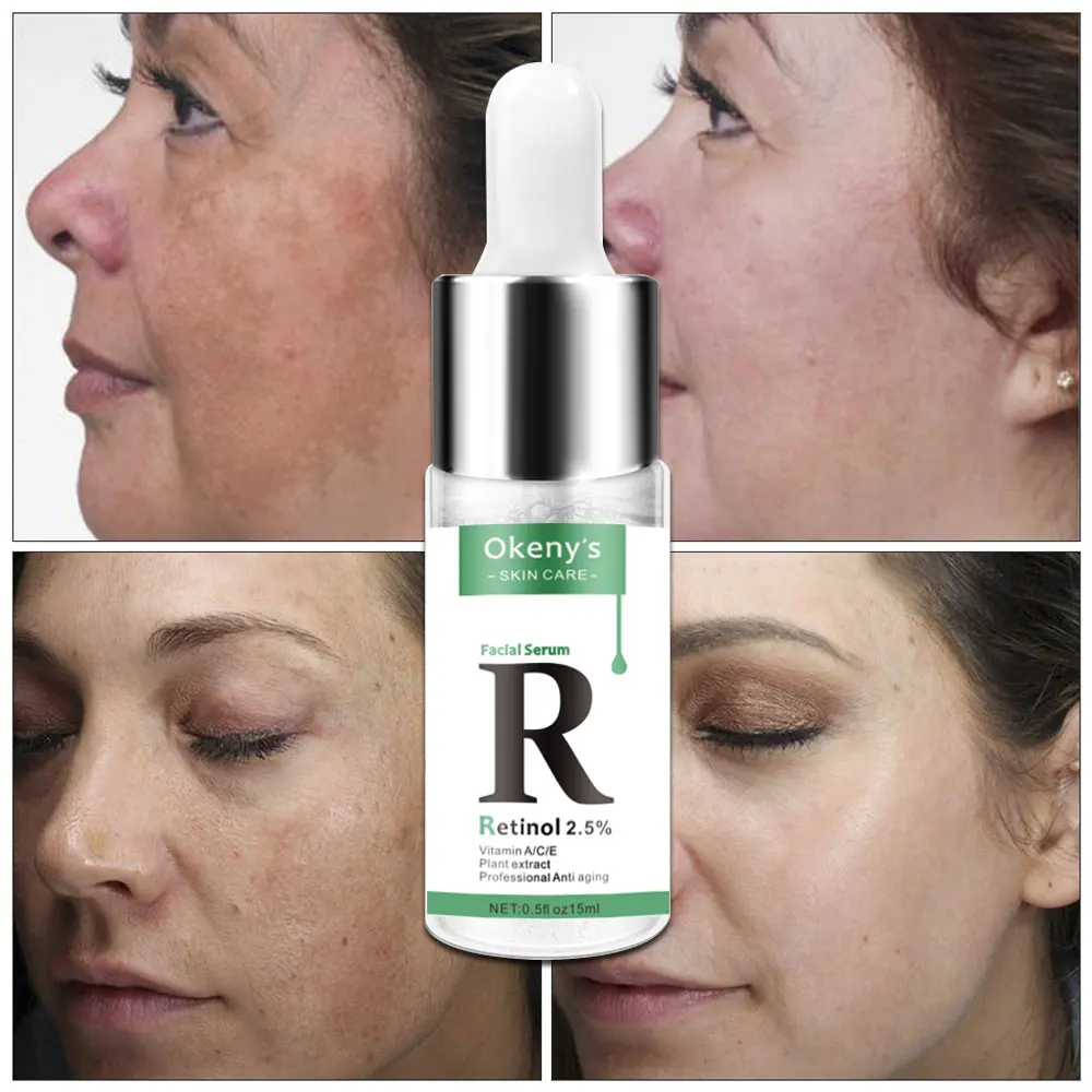 Retinol 2.5% Vitamin C / A Facial Anti Wrinkle Serum Remove Dark Spots Collagen Whitening Face Aging Essence | Красота и здоровье