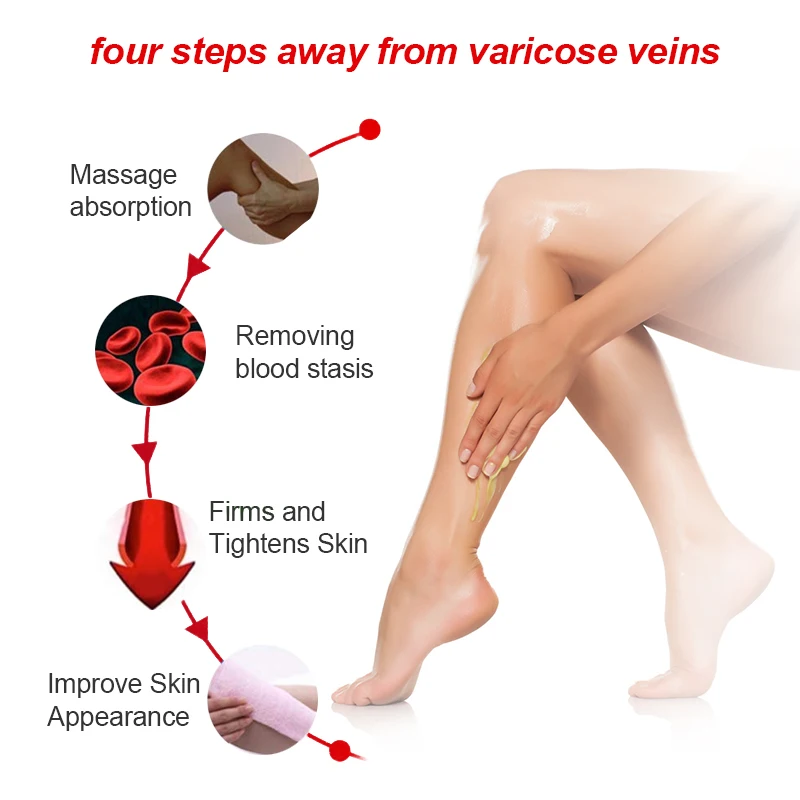 

20g Sumifun New Varicose Veins Treatment Cream 100% Original Vasculitis Phlebitis Spider Pain Relief Ointment Medical Plaster
