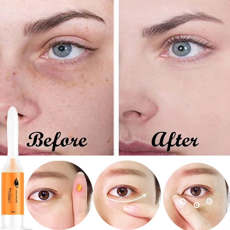 

5ml Eye Skin Care Anti-Wrinkler Deep Moisturizing Nourishing Eye Cream Remove Dark Circles Anti-Puffiness Skin Care