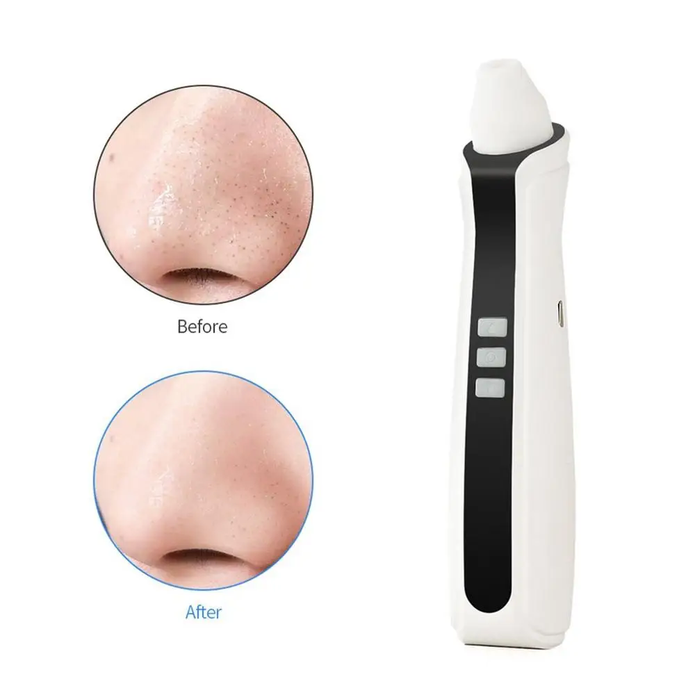 USB Перезаряжаемый прибор для удаления черных точек и пор лица пылесос с Черной