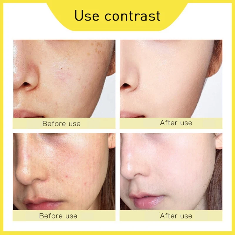 5pcs Stay Up Late First-Aid Repair Mask Moisturizing Face Nourishing No-Clean Skin Solution | Красота и здоровье
