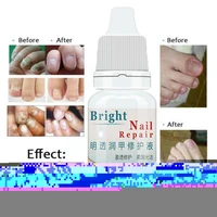 30ml nail repair essence nail toenail fungus anti fungal oil foot cuticle onychomycosis tslm1 remove serum care nail gel e9s1