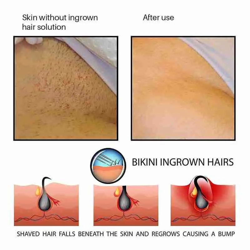 

100ml Beard Cream Essence Bump Stopper Prevent Smooth Mild Skin Ingrown Serum Repair After & Skin Treatment Hair I8H6