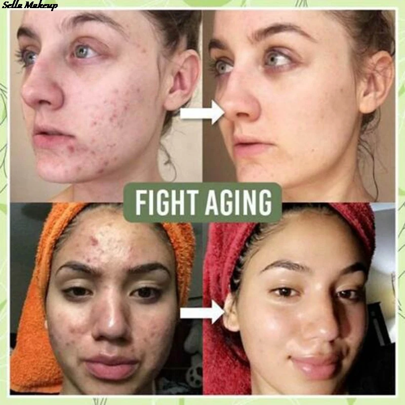 

New High Quality Green Tea Cooling Cleansing Facial Mud Mask Oil Control Deep Cleaning Blackhead Remover Face Care Mask