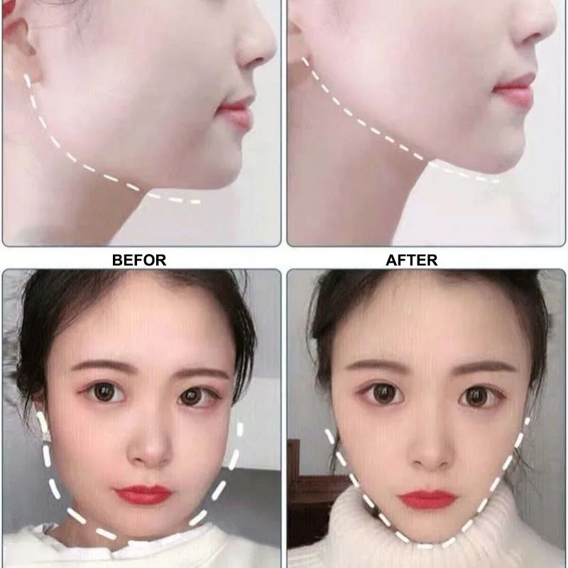 

5/10Pcs V Face Mask Small Face Hanging Ear Lifting Tightening Eliminate Double Chin Edema Lifting Firming Facial Line Face Care