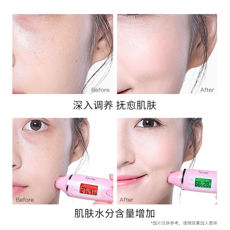 Beilingmei gold ladies luxury 9 pieces set to fade dark moisturizing oil control care skin products |