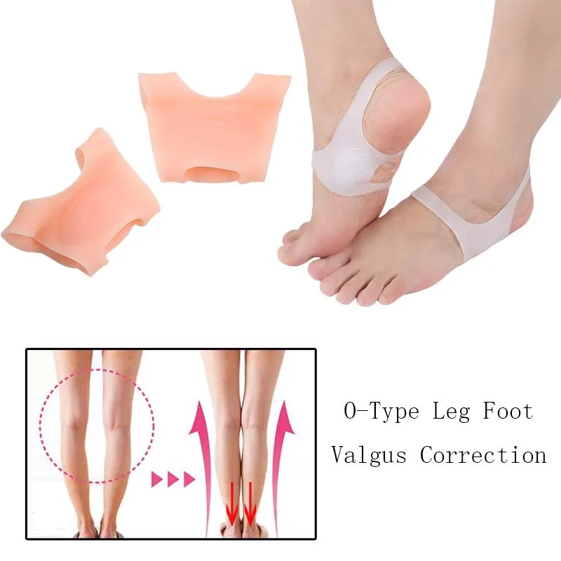 

1Pair SEBS Silicone Unisex Shock-Absorbant For 'O' Leg Varus Breathable Hallux Valgus Corrector Orthotics Insoles Bandage