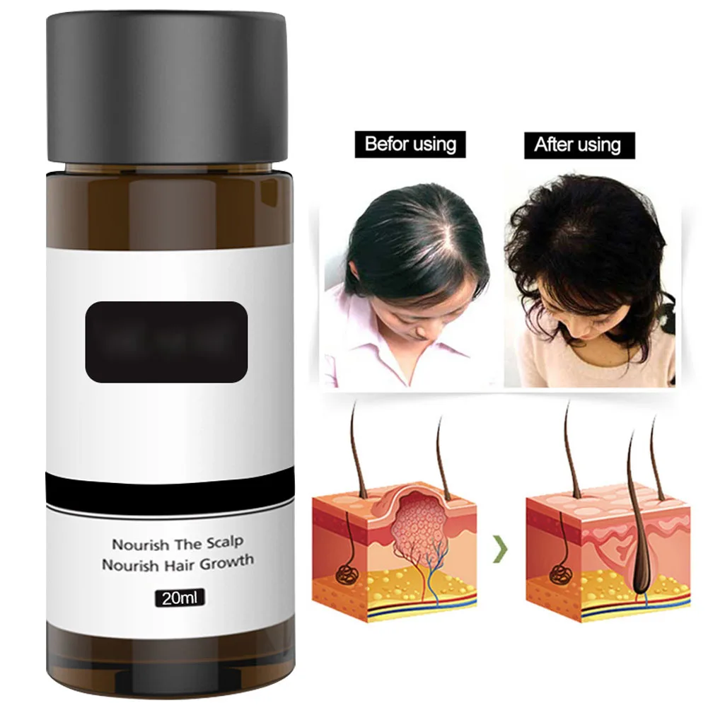 

20 Ml Treatment Gift Damaged Repair Hair Growth Oil Repairing Against Loss Liquid Herbal Smooth Effective Styling Healthy Fast